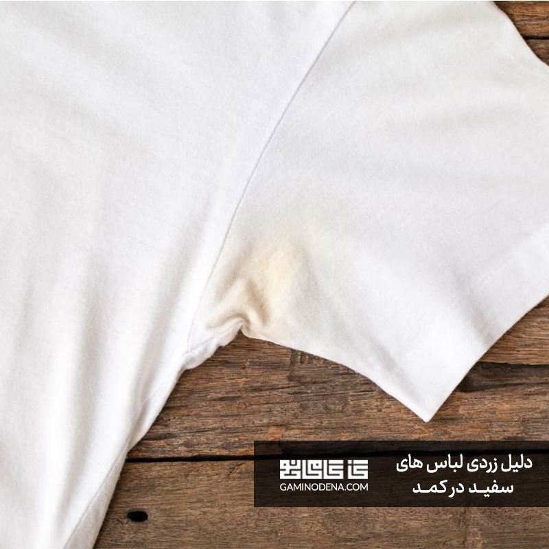 چرا لباس سفید در کمد زرد می شود؟